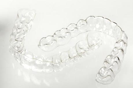 Photo of upper and lower Invisalign aligners.