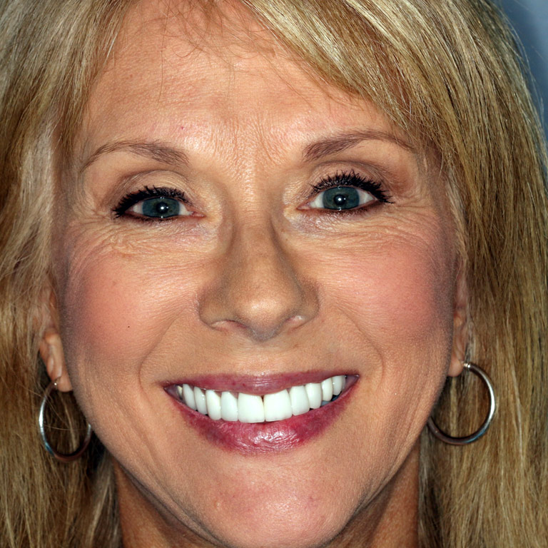 Headshot of blond haired woman smiling showing perfect white teeth