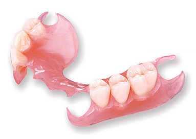 Metal-free Valplast partial denture, which can help a patient with metal allergies or sensitivities