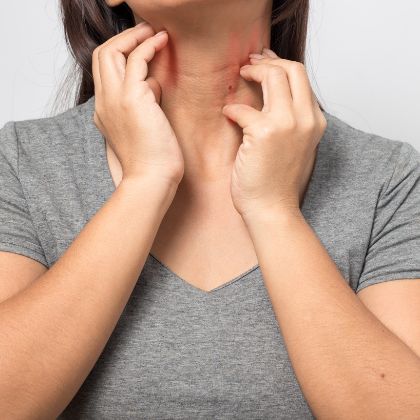 Woman scratching her neck portraying a suspected allergy to silver teeth fillings